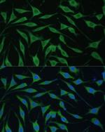 FAM127B Polyclonal Antibody