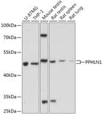 PPHLN1 Polyclonal Antibody