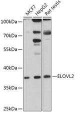 ELOVL2 Polyclonal Antibody