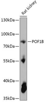 POF1B Polyclonal Antibody