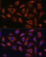 ARFGAP2 Polyclonal Antibody