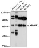 ARFGAP2 Antibody in Western Blot (WB)