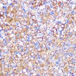 NEK9 Antibody in Immunohistochemistry (Paraffin) (IHC (P))