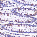 NEK9 Polyclonal Antibody