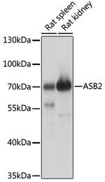 ASB2 Antibody in Western Blot (WB)