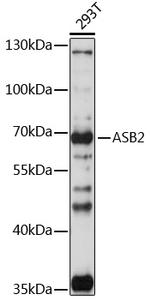 ASB2 Antibody in Western Blot (WB)
