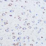Reelin Polyclonal Antibody