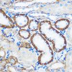 PEBP4 Antibody in Immunohistochemistry (Paraffin) (IHC (P))
