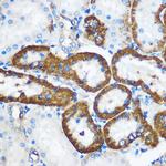 PEBP4 Antibody in Immunohistochemistry (Paraffin) (IHC (P))