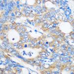 PEBP4 Antibody in Immunohistochemistry (Paraffin) (IHC (P))