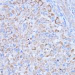 MT-ND1 Antibody in Immunohistochemistry (Paraffin) (IHC (P))