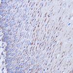 MT-ND1 Antibody in Immunohistochemistry (Paraffin) (IHC (P))