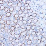 MT-ND1 Antibody in Immunohistochemistry (Paraffin) (IHC (P))