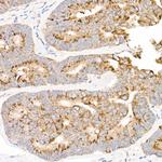 MT-ND2 Antibody in Immunohistochemistry (Paraffin) (IHC (P))