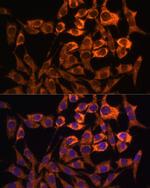 MT-ND3 Antibody in Immunocytochemistry (ICC/IF)