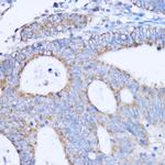 MT-ND3 Antibody in Immunohistochemistry (Paraffin) (IHC (P))