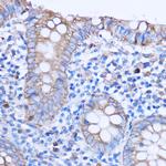 MT-ND3 Antibody in Immunohistochemistry (Paraffin) (IHC (P))