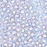 MT-ND3 Antibody in Immunohistochemistry (Paraffin) (IHC (P))