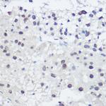 GADD45A Polyclonal Antibody