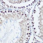 GADD45A Antibody in Immunohistochemistry (Paraffin) (IHC (P))