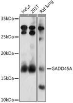 GADD45A Antibody in Western Blot (WB)