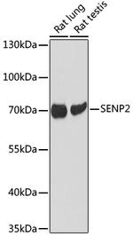 SENP2 Polyclonal Antibody