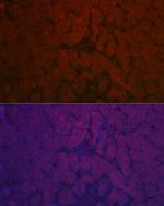 NNMT Antibody in Immunohistochemistry (Paraffin) (IHC (P))