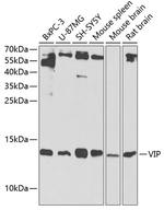 VIP Polyclonal Antibody