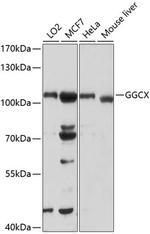 GGCX Polyclonal Antibody