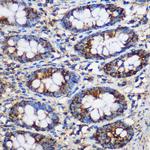TEX101 Antibody in Immunohistochemistry (Paraffin) (IHC (P))