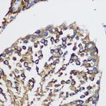 TEX101 Antibody in Immunohistochemistry (Paraffin) (IHC (P))