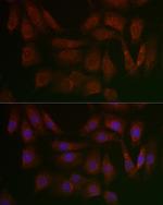 PERK Polyclonal Antibody