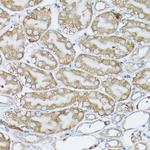 p130Cas Polyclonal Antibody