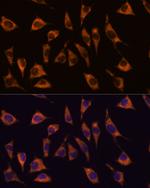 GPR22 Antibody in Immunocytochemistry (ICC/IF)