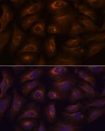 GPR22 Polyclonal Antibody