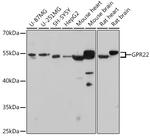 GPR22 Antibody in Western Blot (WB)