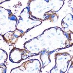 HSPB7 Polyclonal Antibody