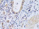 PTGIR Polyclonal Antibody