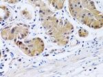 PTGIR Antibody in Immunohistochemistry (Paraffin) (IHC (P))