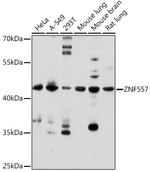 ZNF557 Antibody in Western Blot (WB)