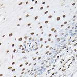 Histone H1T Polyclonal Antibody