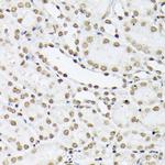Histone H1T Antibody in Immunohistochemistry (Paraffin) (IHC (P))