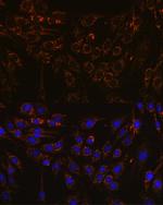 IFNAR1 Antibody in Immunocytochemistry (ICC/IF)