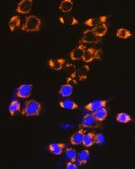 IFNAR1 Polyclonal Antibody