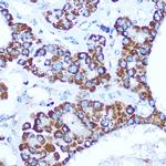 Caspase 1 Antibody in Immunohistochemistry (Paraffin) (IHC (P))