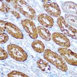 Caspase 1 Antibody in Immunohistochemistry (Paraffin) (IHC (P))