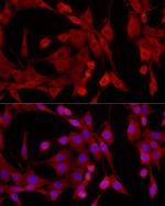 EPHX2 Polyclonal Antibody