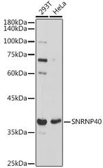 SNRNP40 Antibody in Western Blot (WB)