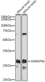 SNRNP40 Polyclonal Antibody