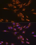 CNTF Polyclonal Antibody